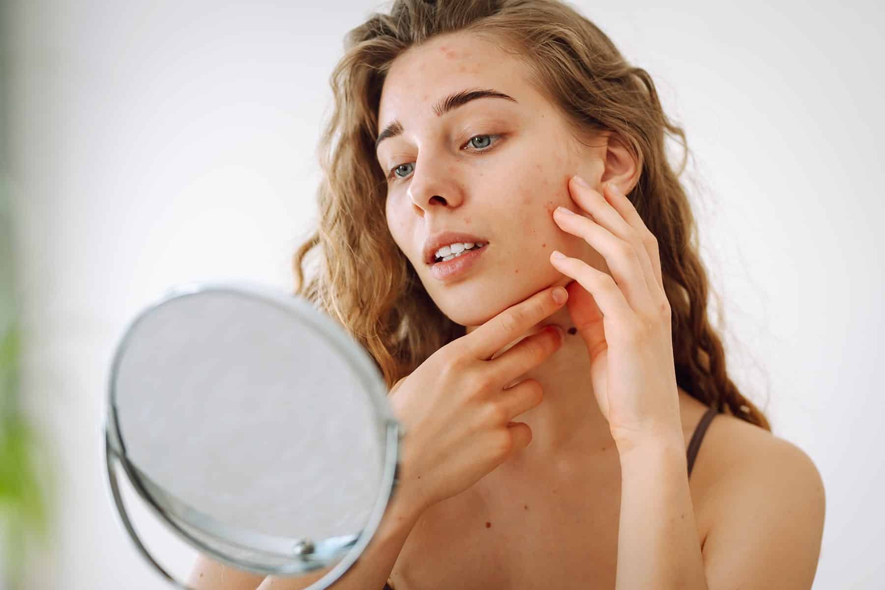 Doctor for sun spots in Rocklin, CA