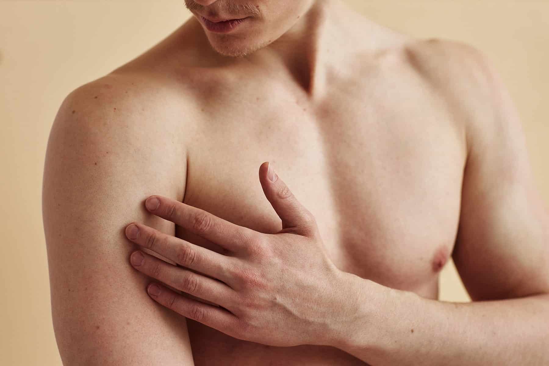 Excessive sweating doctor in Rocklin, CA