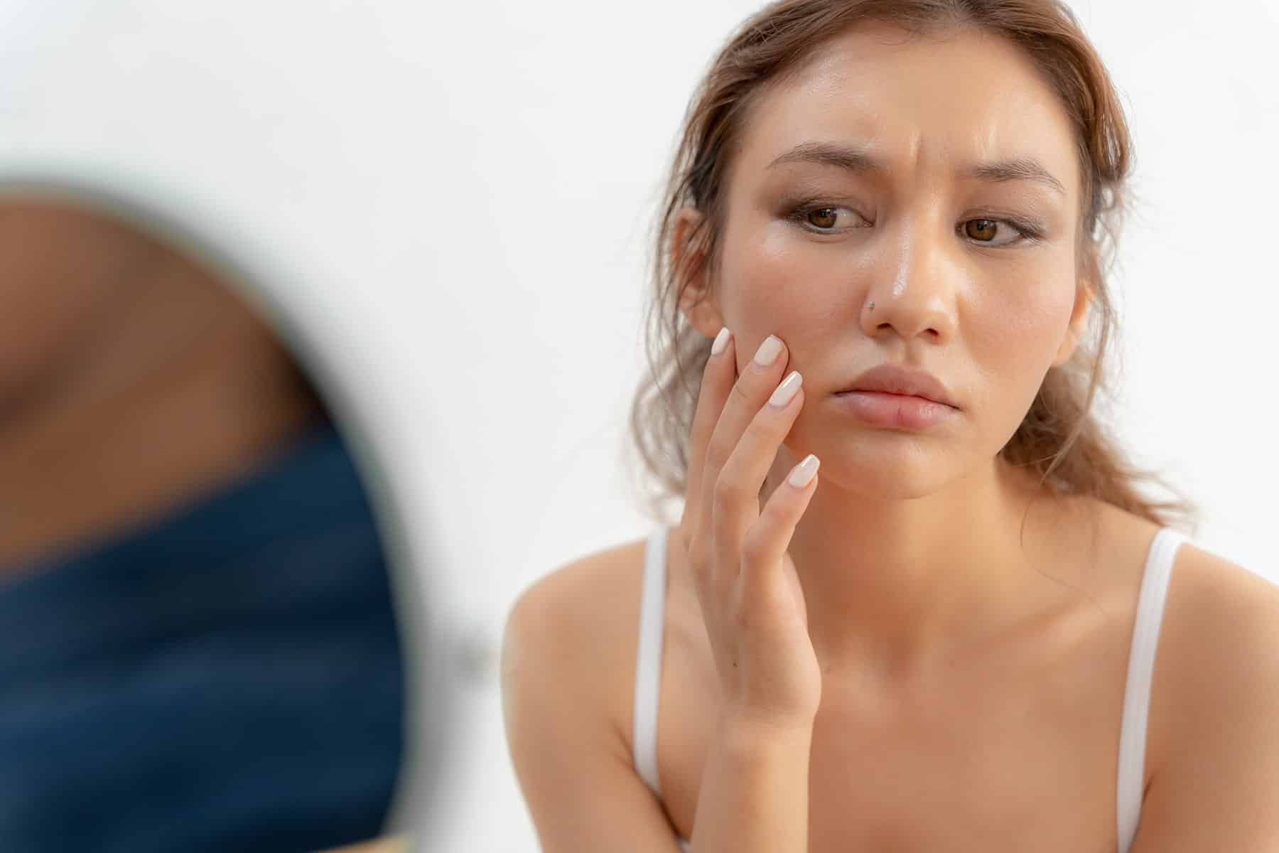 Skin redness treatment in Rocklin, CA