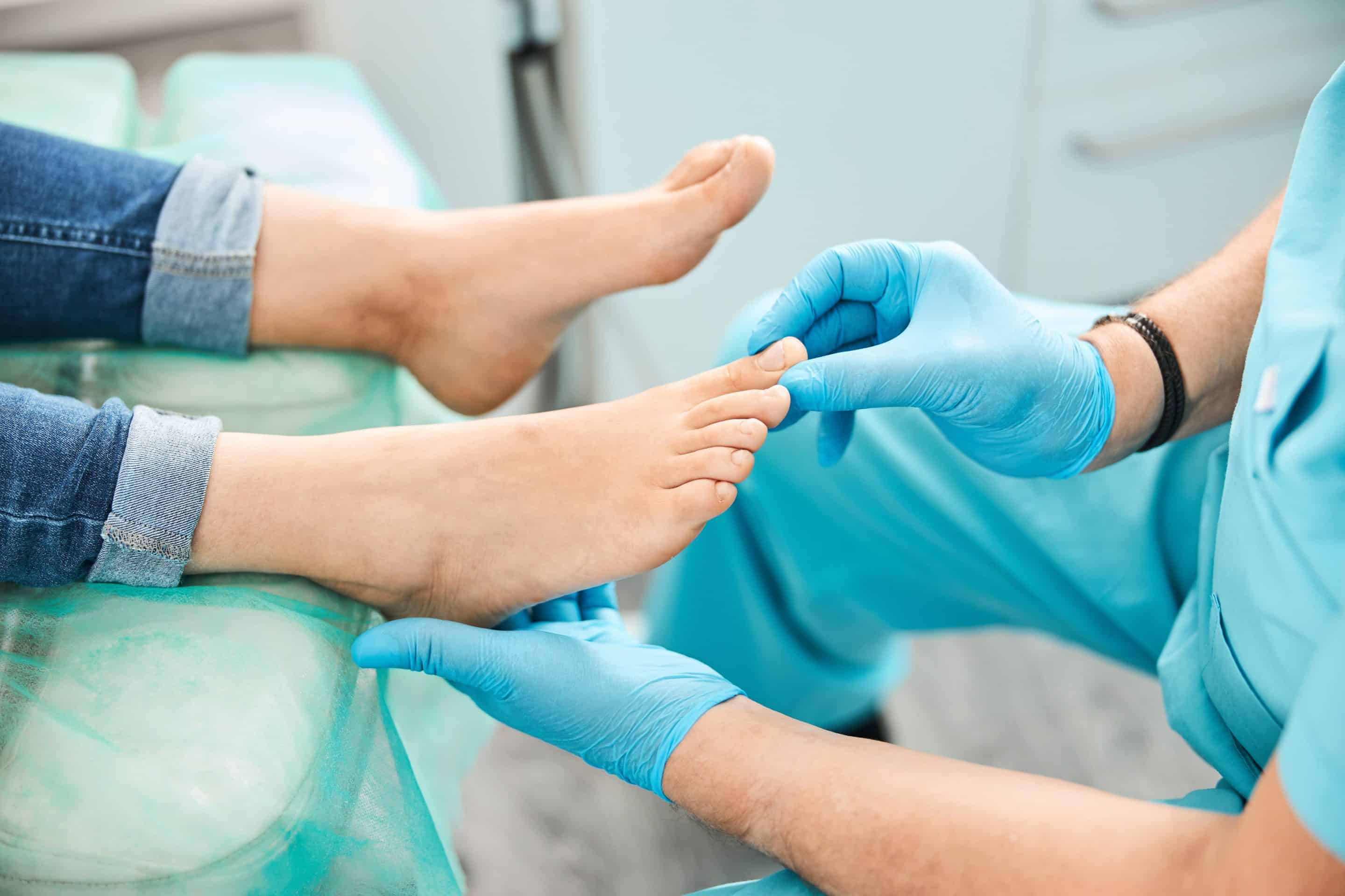 Toe nail fungus doctor in Auburn and Rocklin, CA