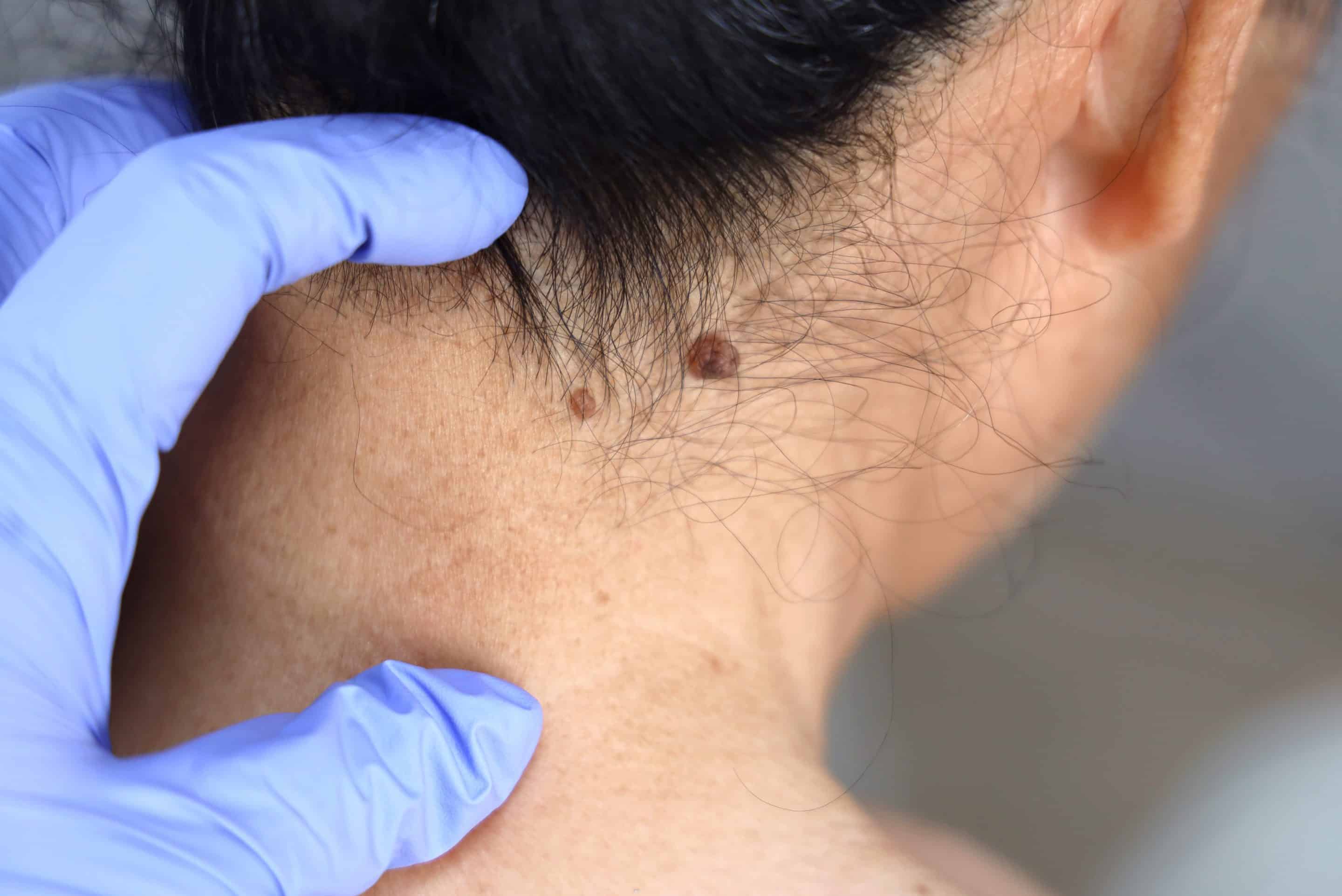 Skin dog treatments in Rocklin, CA
